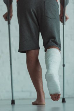 Back view of man with leg in plaster bandage walking with crutches