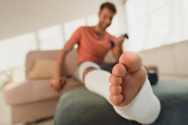Selective focus of broken leg of man with dumbbell on couch