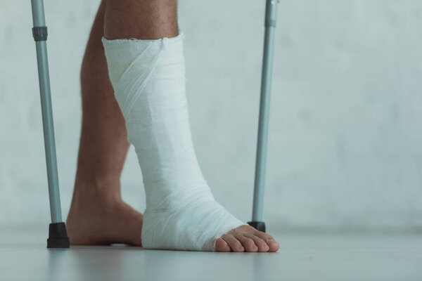 Cropped view of man with gypsum on leg holding crutches 