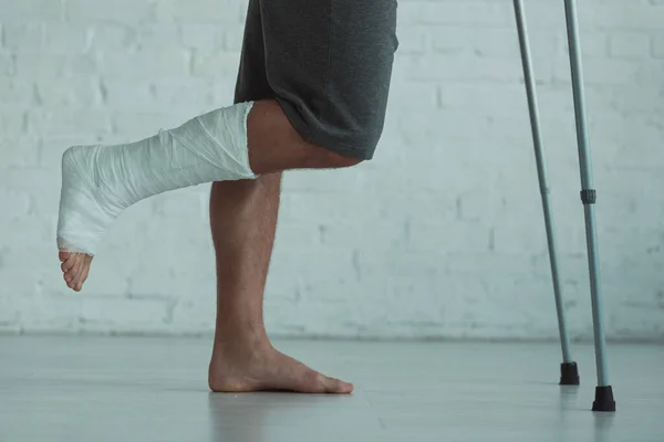 Widok Boku Człowieka Nogą Gipsowym Bandażu Trzymającym Kule — Zdjęcie stockowe