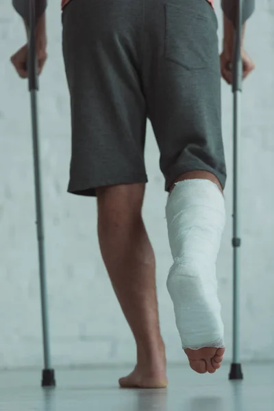 Visão Traseira Homem Com Perna Bandagem Gesso Andando Com Muletas — Fotografia de Stock