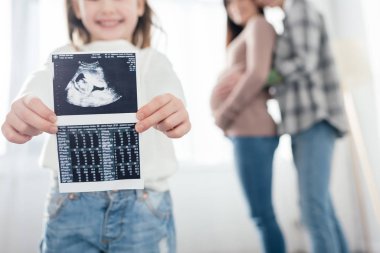 Bebek ultrasonu gösteren gülümseyen bir çocuk görüntüsü. Bu arada evde hamile bir kız arkadaşını kucaklayan bir kadın.