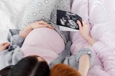 Overhead view of same sex couple holding ultrasound scans of baby on bed  clipart