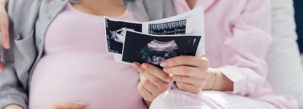 Vágott Nézet Ugyanarról Szexpárról Akik Ultrahang Felvételeket Tartanak Babáról Ágyban — Stock Fotó