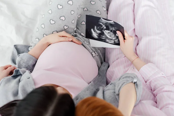 同性夫妇在床上抱着婴儿超声波扫描的俯视图 — 图库照片