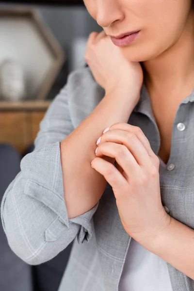 Pandangan Terpotong Dari Wanita Alergi Menggaruk Tangan — Stok Foto
