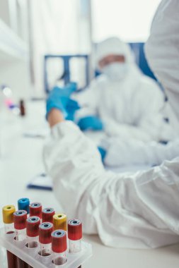 Laboratuvarda biyokimyagerlerin yakınında kan örnekleri bulunan test tüplerinin seçici odağı