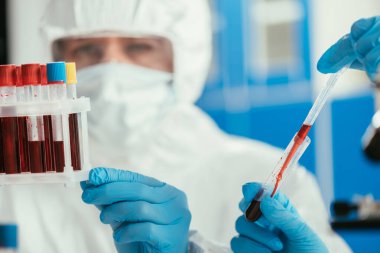 Kan örnekleriyle test tüpleri tutan biyokimyagerlerin seçici odak noktası