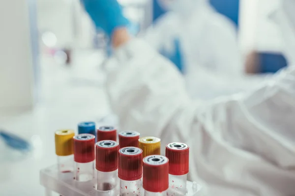 Selective Focus Test Tubes Blood Samples Biochemists Lab — Stock Photo, Image