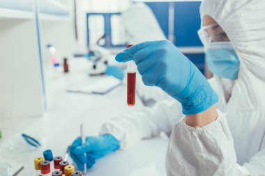 selective focus of biochemist writing while holding test tube with blood sample clipart