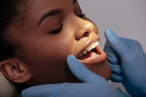 Orthodontist Latex Gloves Happy African American Woman Braces — Stock Photo, Image