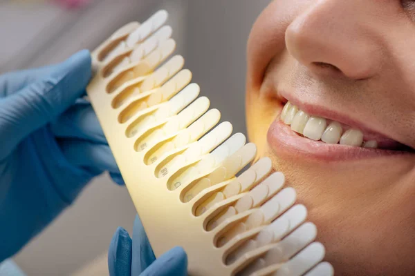 Vista Cortada Dentista Luvas Látex Segurando Paleta Dentes Perto Homem — Fotografia de Stock