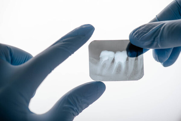 cropped view of dentist in latex gloves holding x-ray of teeth on white 