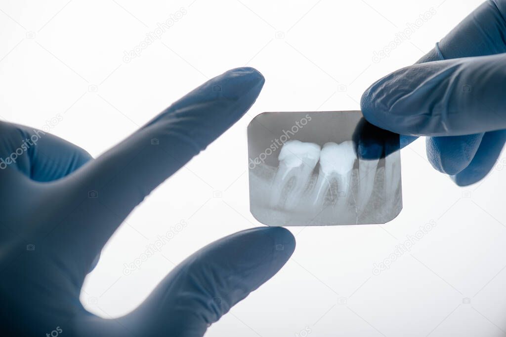 cropped view of dentist in latex gloves holding x-ray of teeth on white 
