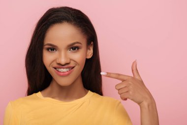 Gülümseyen Afrikalı Amerikalı kız pembe dişlerinin diş tellerini işaret ediyor.