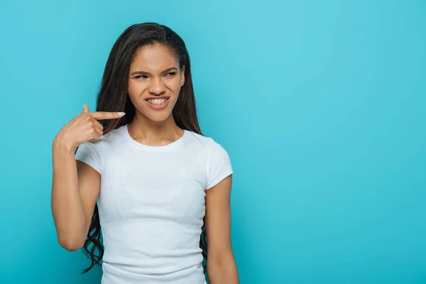 Scontento Ragazza Afroamericana Indicando Bretelle Dentali Sui Denti Isolati Blu — Foto Stock