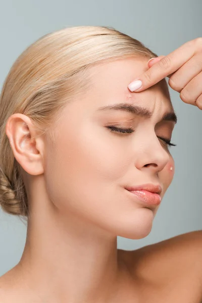 Displeased and naked girl touching face with acne isolated on grey — Stock Photo