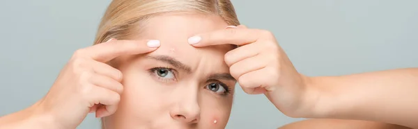 Panoramic shot of girl pointing with fingers at acne on face isolated on grey — Stock Photo