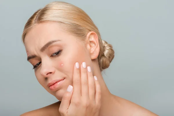 Perturbado menina tocando rosto com acne isolado no cinza — Fotografia de Stock