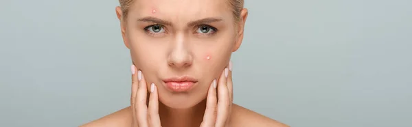 Panoramic shot of upset girl touching face with acne isolated on grey — Stock Photo