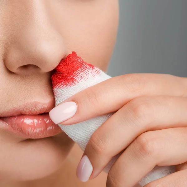 Perto de mulher ferida segurando bandagem com sangue isolado em cinza — Fotografia de Stock