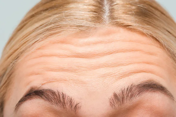 Close up of forehead with wrinkles of woman — Stock Photo