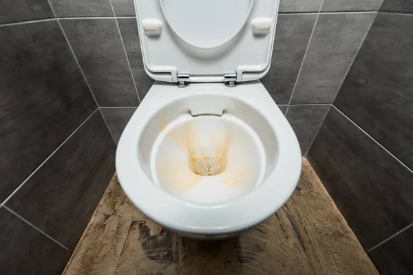 Detergente líquido amarelo em vaso sanitário cerâmico limpo em banheiro moderno com azulejo cinza — Fotografia de Stock