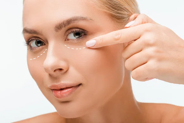 Hermosa mujer apuntando con el dedo a las marcas de cirugía plástica bajo los ojos aislados en blanco - foto de stock