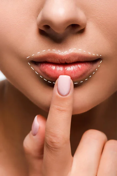 Cropped view of woman pointing with finger at lips with lip augmentation marks — Stock Photo