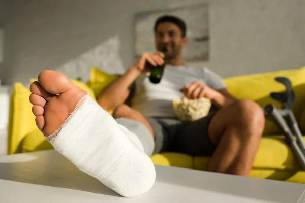 Mann mit gebrochenem Bein trinkt Bier und isst Popcorn auf Couch im Wohnzimmer — Stockfoto