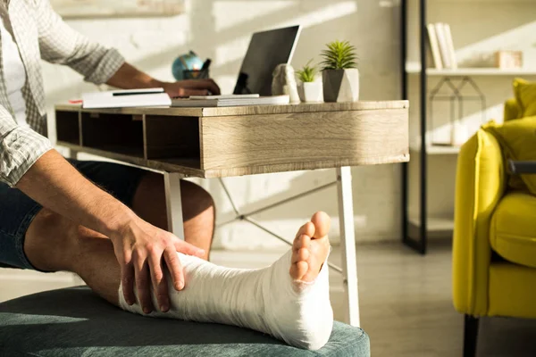 Vista recortada del hombre tocando la pierna rota mientras usa el ordenador portátil en casa - foto de stock