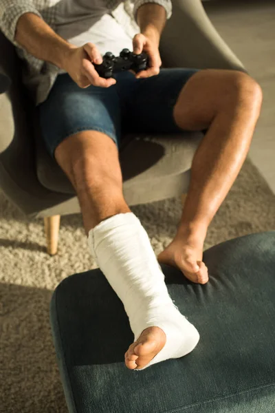 KYIV, UKRAINE - JANUARY 21, 2020: Selective focus of man with broken leg playing video game in armchair — Stock Photo