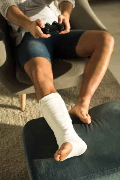 KYIV, UKRAINE - 21 JANVIER 2020 : Mise au point sélective de l'homme avec jambe cassée jouant au jeu vidéo dans un fauteuil — Photo de stock