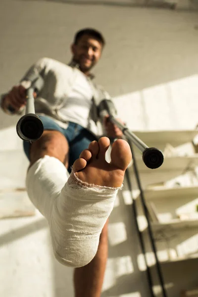 Visão de baixo ângulo do homem com a perna em bandagem de gesso segurando muletas e sorrindo para a câmera — Fotografia de Stock