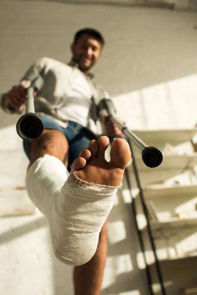 Vista de bajo ángulo del hombre con pierna en vendaje de yeso sosteniendo muletas y sonriendo a la cámara — Stock Photo
