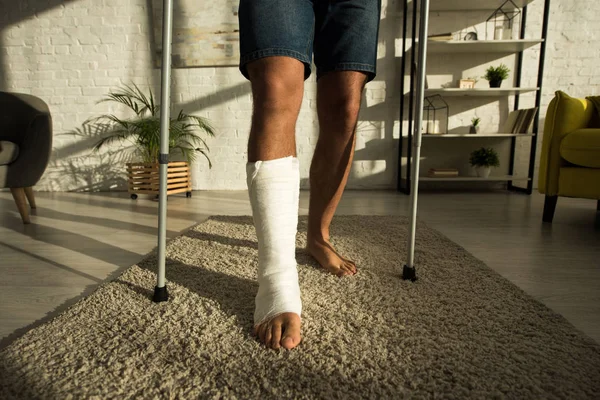 Vue recadrée de l'homme avec la jambe cassée tenant des béquilles à la maison — Photo de stock