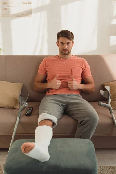 Schöner Mann mit Bein in Gipsverband zeigt Daumen nach oben auf Couch — Stockfoto