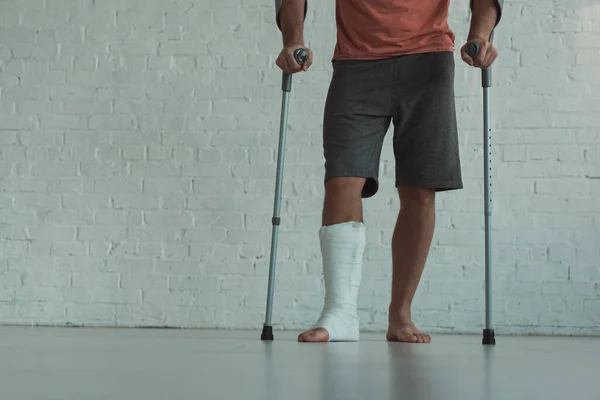 Vista cortada do homem com a perna quebrada segurando muletas — Fotografia de Stock