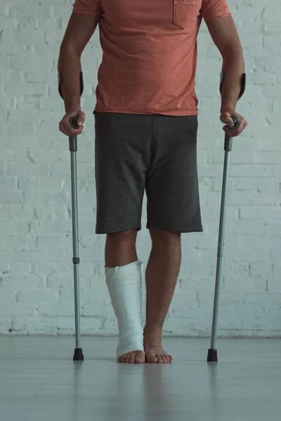 Cropped view of man with leg in plaster bandage holding crutches — Stock Photo