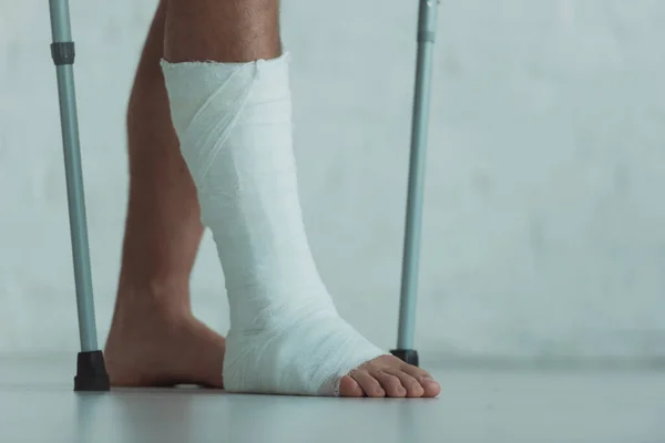 Cropped view of man with gypsum on leg holding crutches — Stock Photo