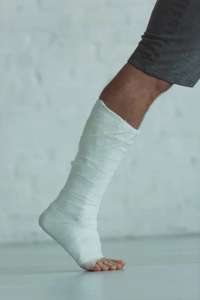 Cropped view of broken leg of man in gypsum — Stock Photo