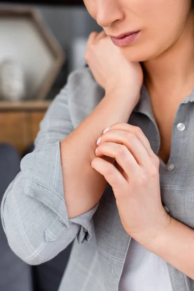 Vista recortada de la mujer alérgica rascarse la mano - foto de stock