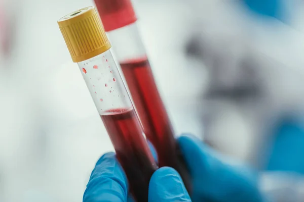 Vue partielle du biochimiste tenant des éprouvettes avec des échantillons de sang — Photo de stock
