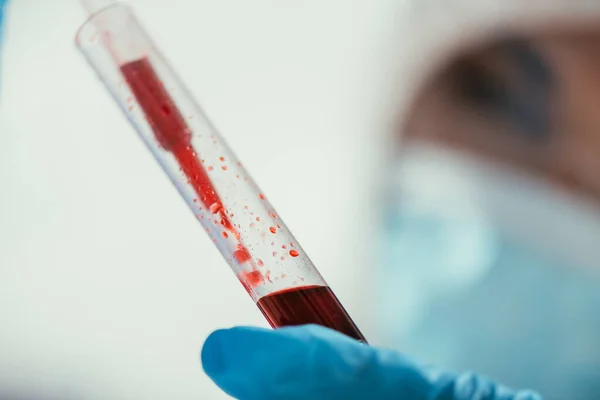 Close up view of test tube with blood sample and pipette in hands of biochemist — Stock Photo