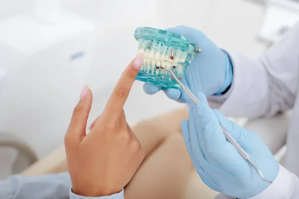 Vista ritagliata di donna afro-americana che punta con il dito al modello di denti con carie vicino al dentista in guanti di lattice — Foto stock