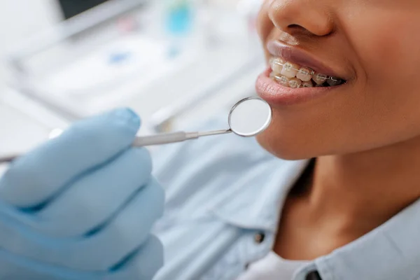 Vista recortada de ortodoncista en guante de látex sosteniendo espejo dental cerca de paciente afroamericano feliz en frenos - foto de stock