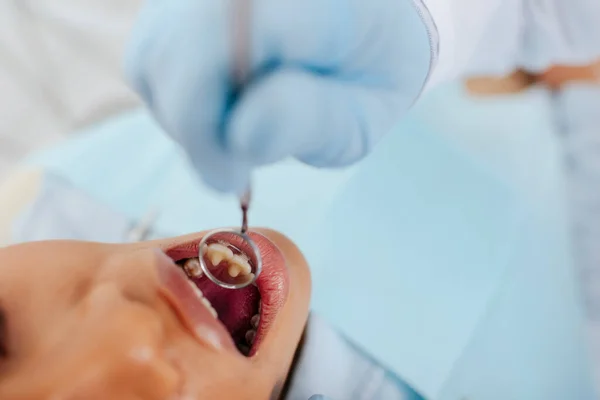 Vista superior del dentista en guante de látex que sostiene el espejo dental cerca del paciente afroamericano con la boca abierta - foto de stock