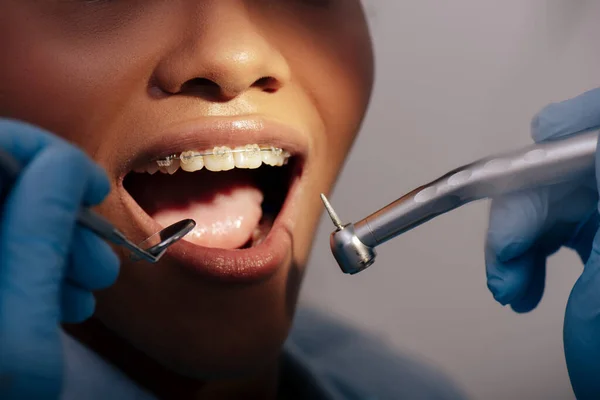 Vista ritagliata di ortodontista in guanti di lattice in possesso di strumenti dentali vicino felice donna africana americana in bretelle — Foto stock