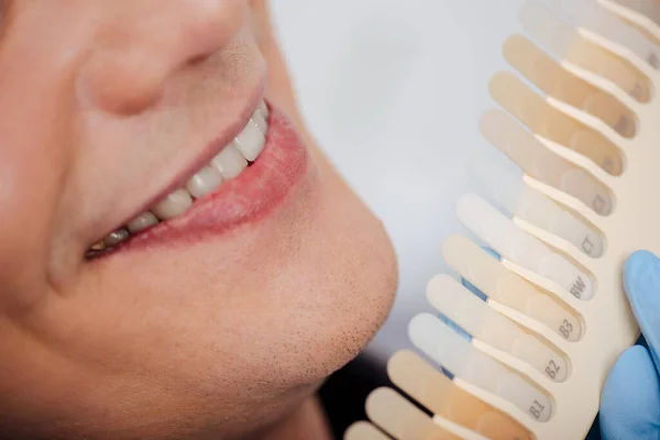 Cropped view of man smiling near teeth palette in clinic — Stock Photo
