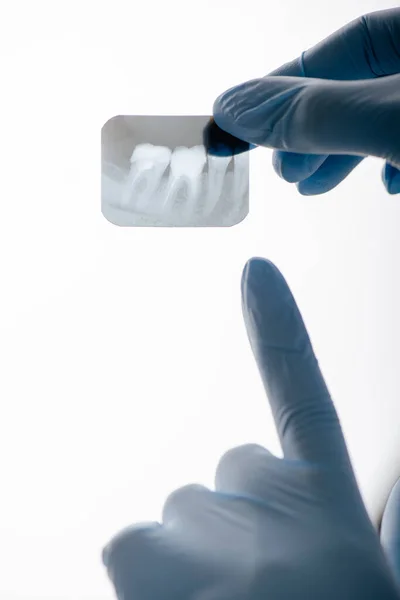 Vista recortada del dentista en guantes de látex apuntando con el dedo a la radiografía de dientes en blanco - foto de stock